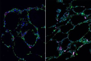 3-d-bioengineered-lung_indianbureaucracy