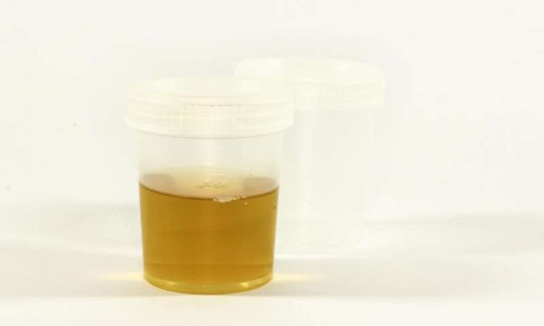 urine test -Indian Bureaucracy