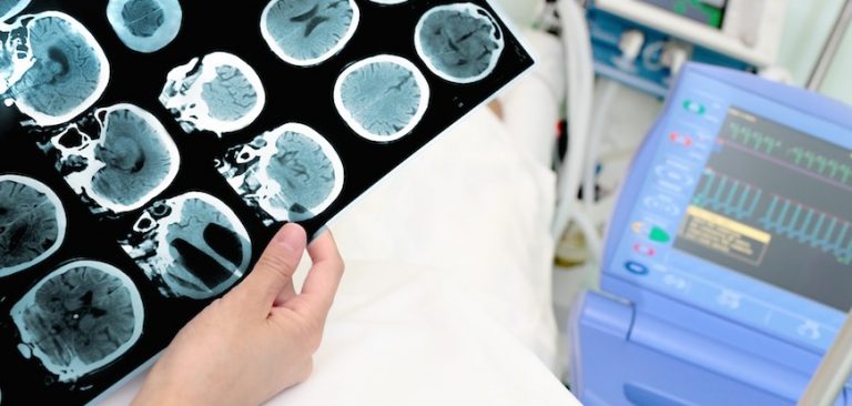Neurosurgical practices-IndianBureaucracy