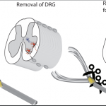 New surgical strategy offers hope for repairing spinal injuries