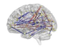 infant brain connections