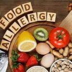 food allergies
