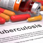 Health Ministry introduces Daily Drug Regimen for treatment of Tuberculosis