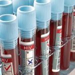 State-of-the-art HIV