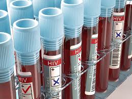 State-of-the-art HIV