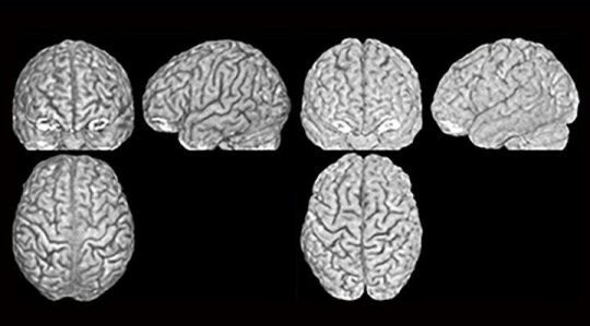 unique brain anatomy