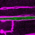 Can we teach heart cells to grow up