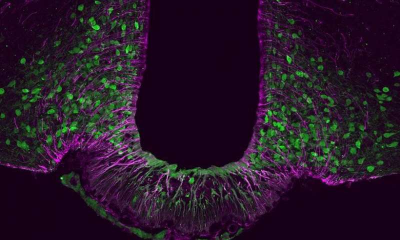 Identity crisis of satiety neurons leads to obesity