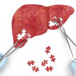 New insights on liver injury in men taking body
