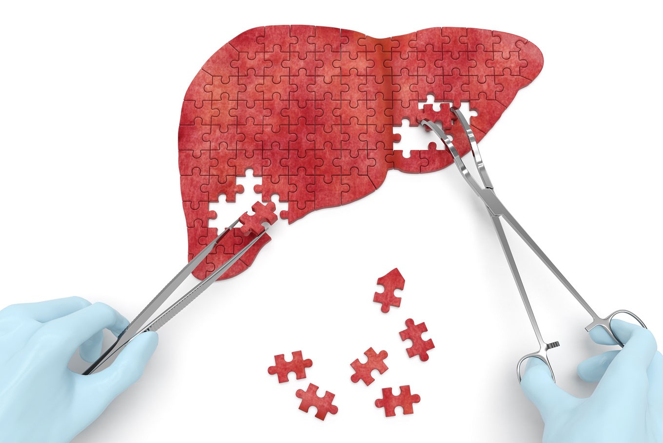 New insights on liver injury in men taking body