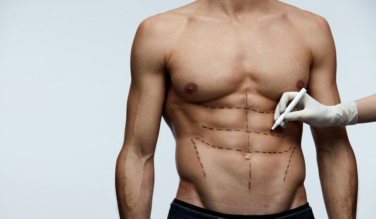 With abdominal etching, plastic surgeons help patients get 'six-pack abs'