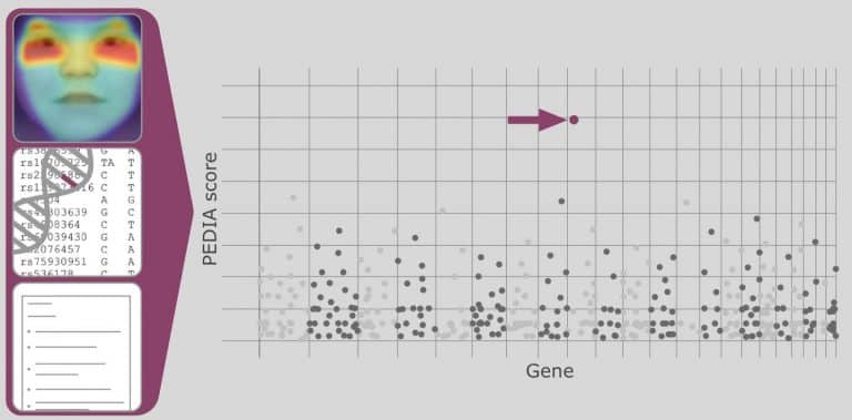 How artificial intelligence can help detect rare diseases