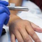 Pain signaling in humans is more rapid now than previously knownv