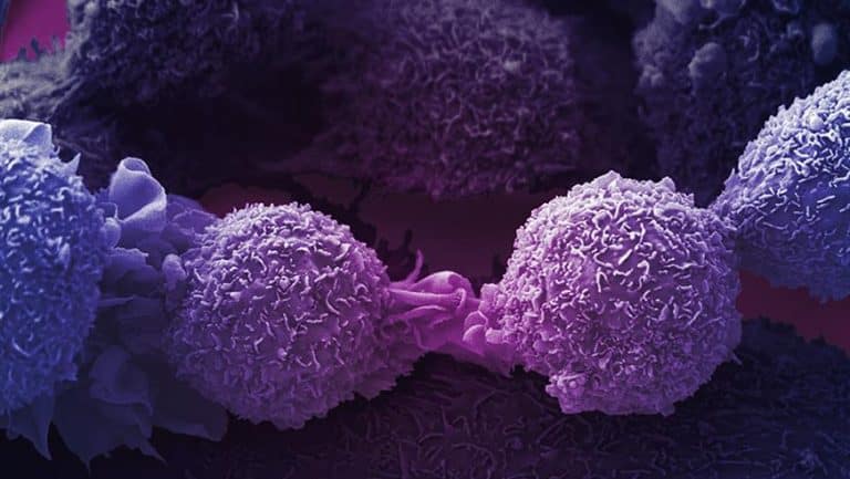Pairing targeted drugs for breast and lung cancer could overcome treatment resistance