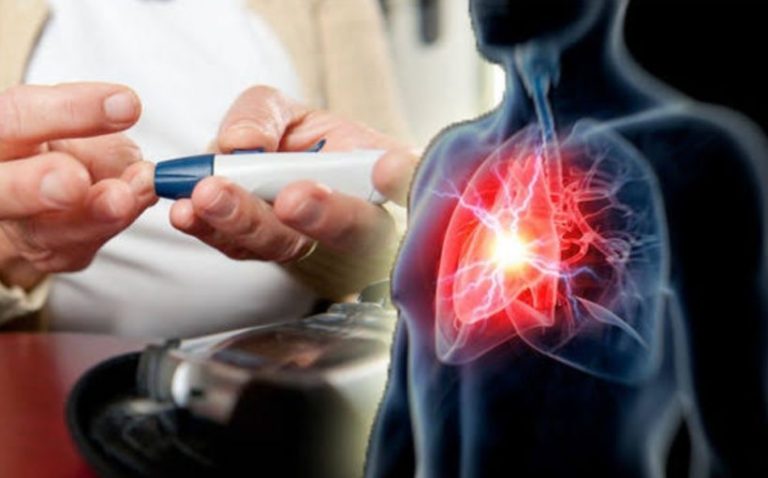 Pollution and winter linked with rise in heart attack treatment