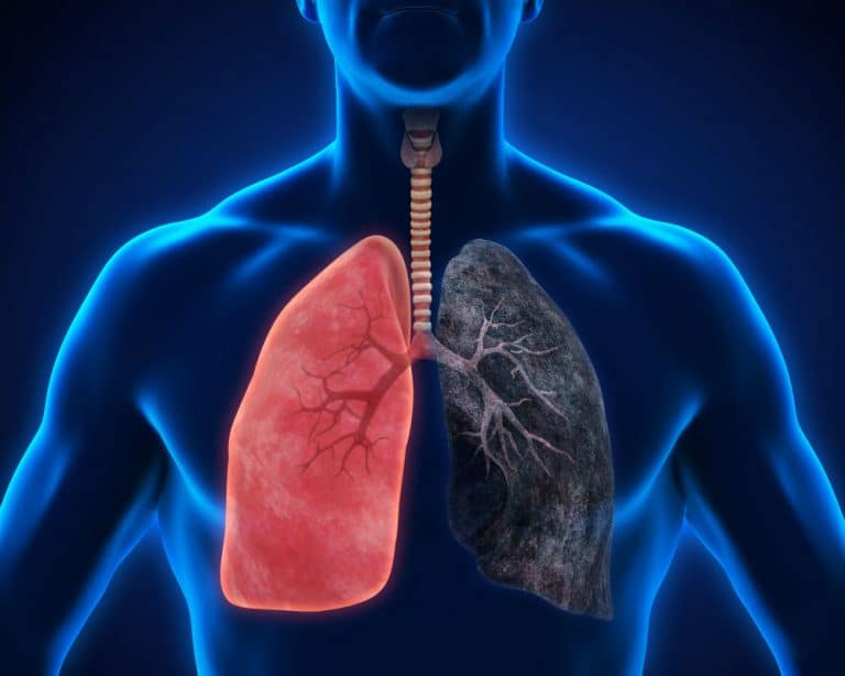 Possible new treatment strategy for lung cancer