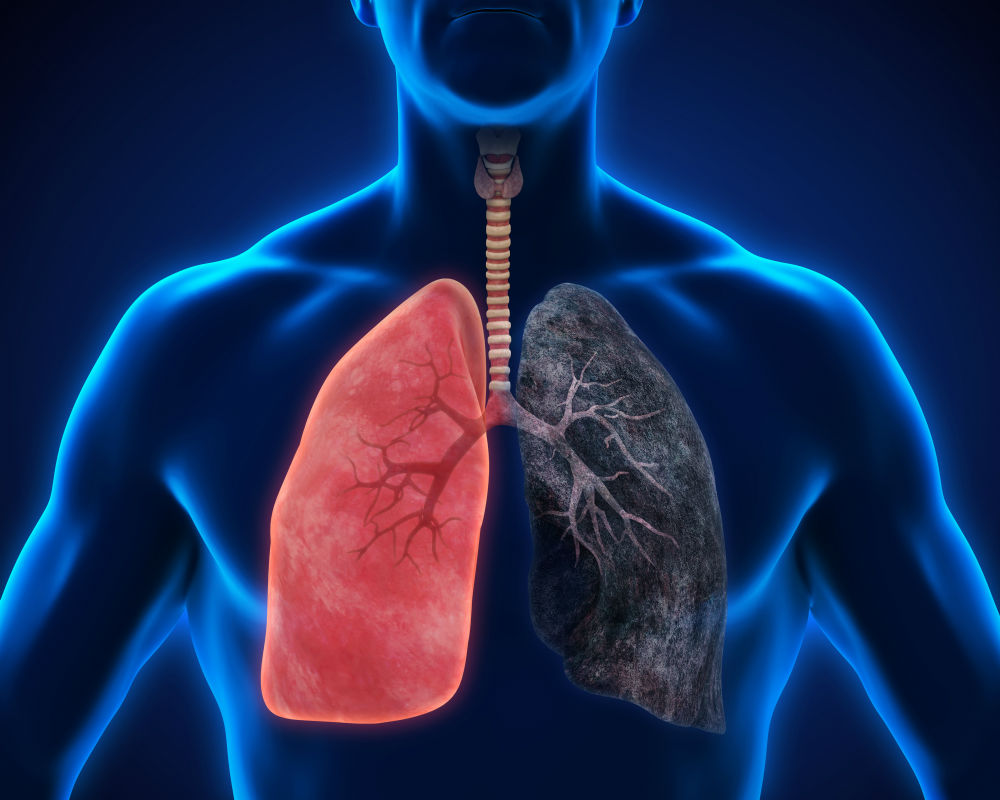 Possible new treatment strategy for lung cancer
