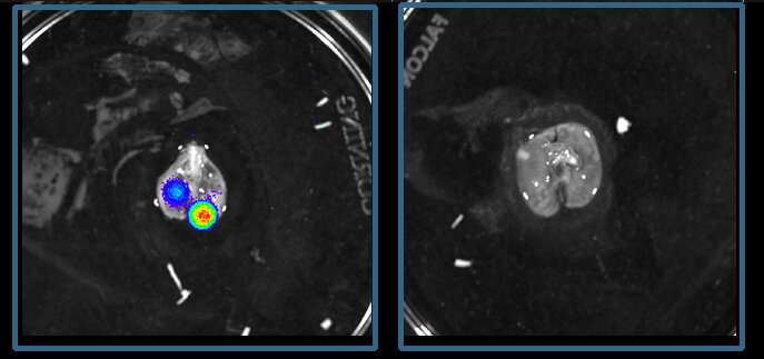 A new route to blocking children bone cancer