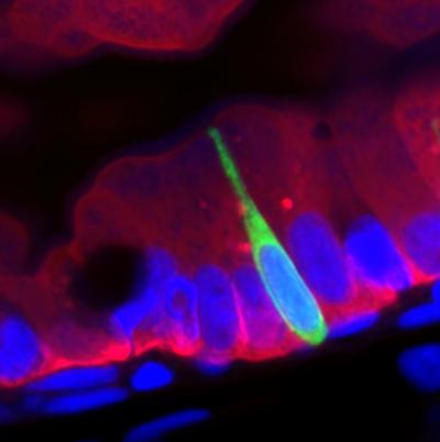 Fatty meal interrupts gut's communication with the body, but why