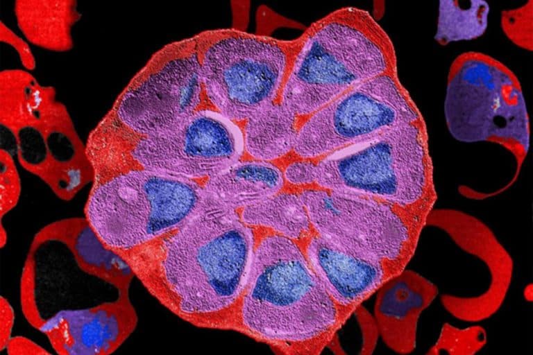 A new breakthrough in developing effective antimalarial drugs