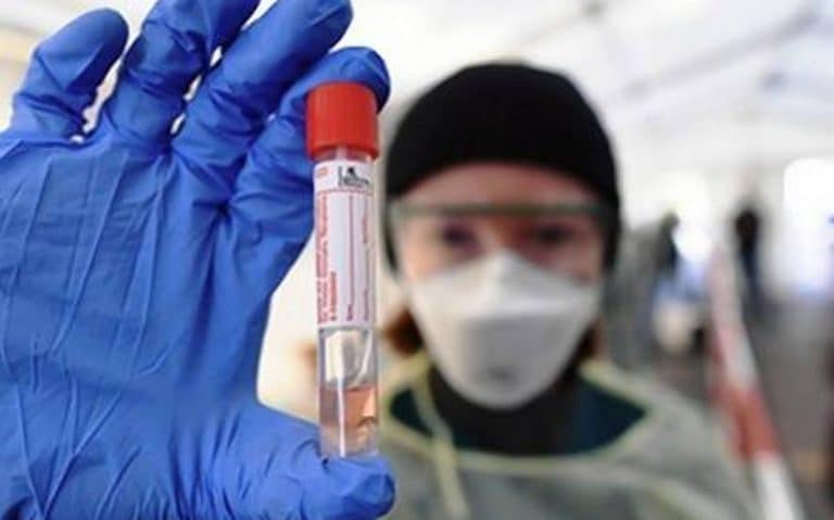 CSIR-IMTECH takes up sample testing for Covid-19