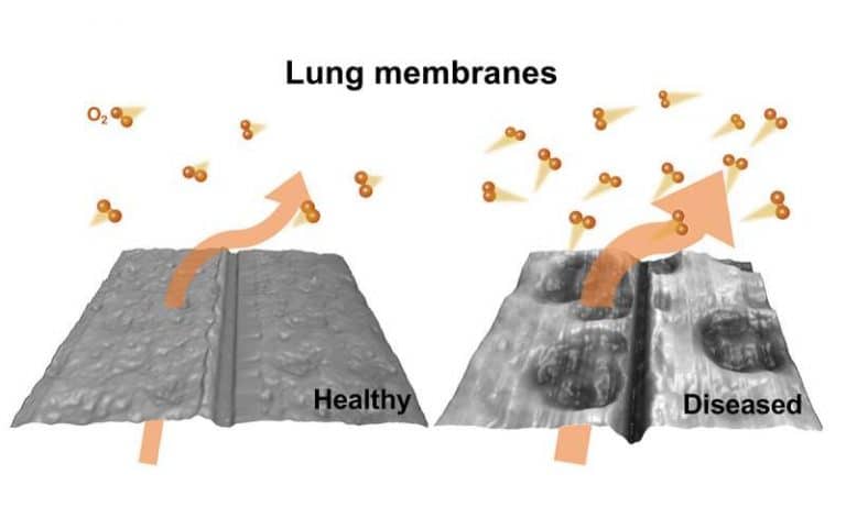 how oxygen transfer is altered in diseased lung tissue