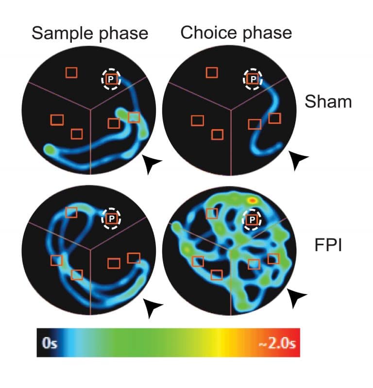 How memory function could be preserved after brain injury