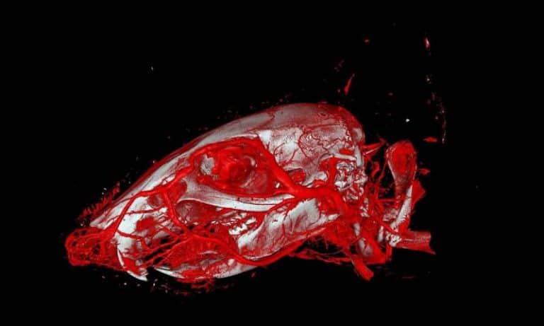 Increased usability and precision in vascular imaging