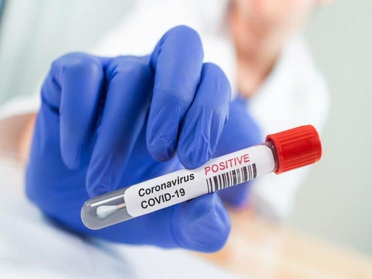 The robust indigenous IgG ELISA test for antibody detect