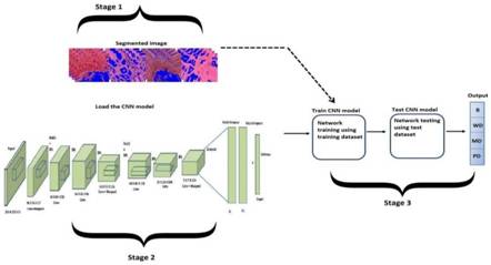 IASST Develops AI based computer diagnosis framework for rapid & accurate diagnIASST Develops AI based computer diagnosis framework for rapid & accurate diagnosis of oral cancersosis of oral cancers