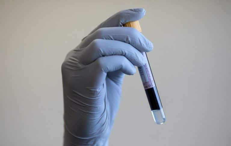 Blood iron levels could be key to slowing aging, gene