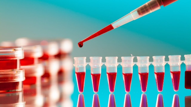 Breakthrough blood test detects positive COVID-19 result in 20 minutes