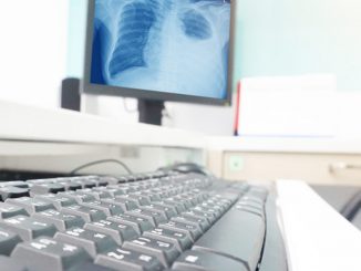 Chest x-rays show more severe COVID-19 in non-white patients