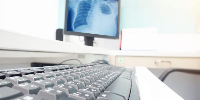 Chest x-rays show more severe COVID-19 in non-white patients
