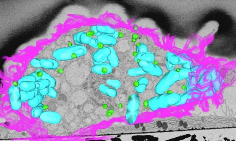 Fats fighting back against bacteria