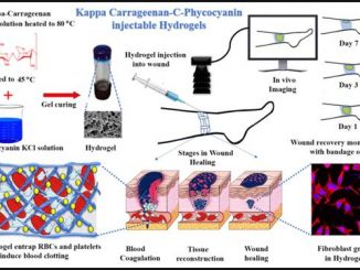 Smart injectable hydrogel