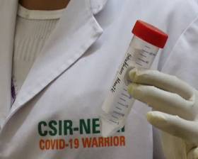 RT-PCR Testing Method