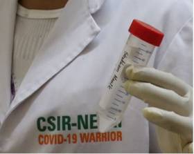 Saline Gargle RT-PCR method